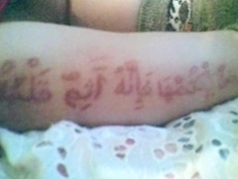 Пластика чтобы быть похожей на звезду Пластика чтобы быть похожей на звезду