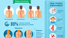 сколиоз сколиоз